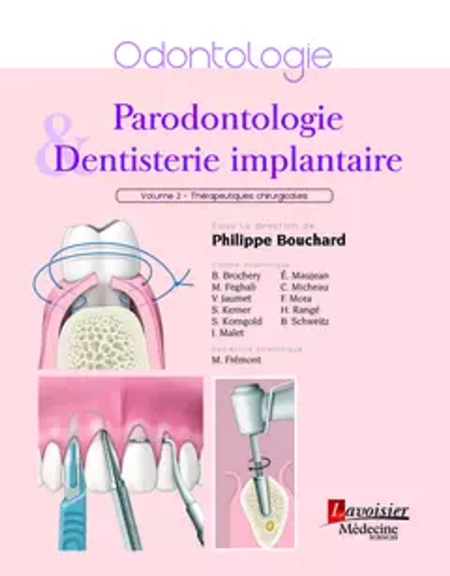 Traité de parodontologie - Volume 2 : aspects chirurgicaux - - Philippe Bouchard (EAN13 : 9782257706317) | e.lavoisier - Ma librairie ebooks